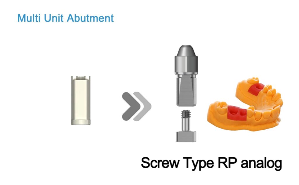 MUA RP_Screw type (3D print model)