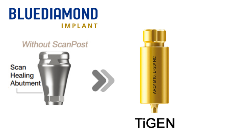 BLUEDIAMOND® NC_SHA (Without Post)_TiGEN_Custom Abutment