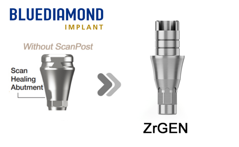 BLUEDIAMOND® RC_SHA (Without Post)_ZrGEN_Ti-base