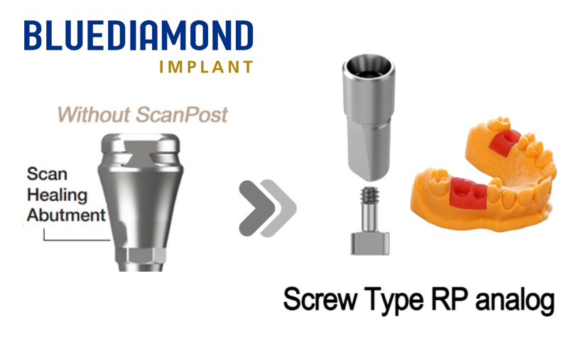BLUEDIAMOND®_SHA(Without post)_Screw Type_Digital Analog