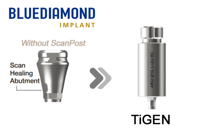 BLUEDIAMOND® RC_SHA (Without Post)_TiGEN_Custom Abutment