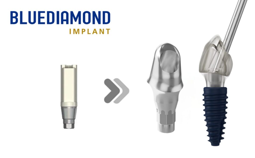 BLUEDIAMOND® RC_Angled Screw Channel (ASC)_R2 Milling Center